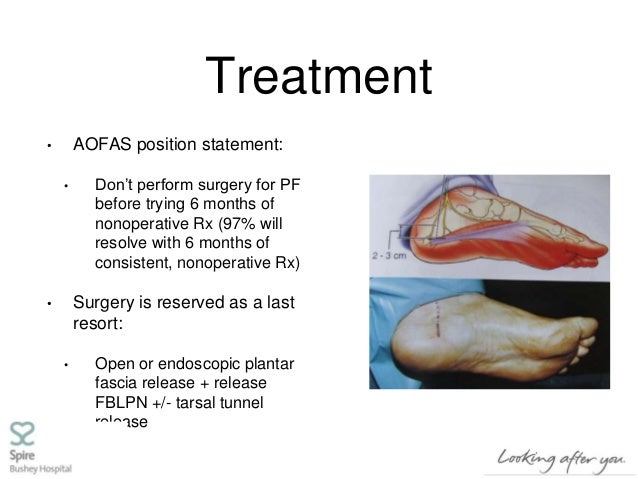 heel pain treatment